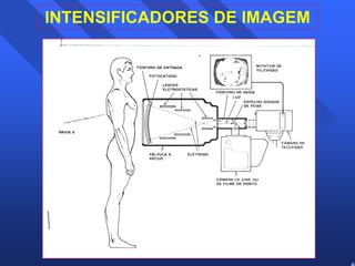 40 
INTENSIFICADORES DE IMAGEM 
 