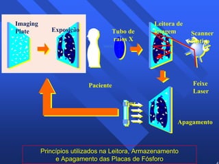 43 
Imaging 
Plate Exposição 
Tubo de 
raios X 
Paciente 
Leitora de 
imagem 
Scanner 
Óptico 
Feixe 
Laser 
Luz 
Apagamento 
Princípios utilizados na Leitora, Armazenamento 
e Apagamento das Placas de Fósforo 
 