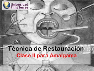 Técnica de Restauración  Clase II para Amalgama 