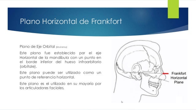 Tecnica de Articulado: Hanau 194, Stratos 300, Whipmix (Manuales)