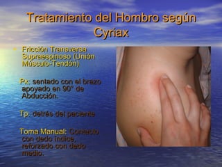 Tratamiento ddeell HHoommbbrroo sseeggúúnn 
CCyyrriiaaxx 
• FFrriicccciióónn TTrraannssvveerrssaa 
SSuupprraaeessppiinnoossoo ((UUnniióónn 
MMúússccuulloo--TTeennddóónn)) 
PPxx:: sseennttaaddoo ccoonn eell bbrraazzoo 
aappooyyaaddoo eenn 9900°° ddee 
AAbbdduucccciióónn. 
TTpp:: ddeettrrááss ddeell ppaacciieennttee 
TToommaa MMaannuuaall:: CCoonnttaaccttoo 
ccoonn ddeeddoo íínnddiiccee,, 
rreeffoorrzzaaddoo ccoonn ddeeddoo 
mmeeddiioo. 
 