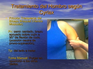 Tratamiento ddeell HHoommbbrroo sseeggúúnn 
CCyyrriiaaxx 
• FFrriicccciióónn TTrraannssvveerrssaa ddeell 
BBíícceeppss BBrraaqquuiiaall ((VViieennttrree 
MMuussccuullaarr)) 
PPxx:: sseemmii-- sseennttaaddoo,, bbrraazzoo 
aappooyyaaddoo ssoobbrree ccoojjíínn aa 
9900°° ddee fflleexxiióónn ddee ccooddoo 
((ppoossiicciióónn nneeuuttrraa ddee 
pprroonnoo--ssuuppiinnaacciióónn)). 
TTpp:: ddeell llaaddoo aa ttrraattaarr. 
TToommaa MMaannuuaall:: PPuullggaarr eenn 
ooppoossiicciióónn aa llooss oottrrooss 
ddeeddooss. 
 