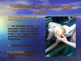 Tratamiento ddeell HHoommbbrroo sseeggúúnn 
CCyyrriiaaxx 
• FFrriicccciióónn TTrraannssvveerrssaa ddeell 
IInnffrraaeessppiinnoossoo 
PPxx:: eenn ddeeccúúbbiittoo pprroonnoo,, 
aappooyyaaddoo ssoobbrree llooss ccooddooss,, 
iinncclliinnaaddoo ssoobbrree eell bbrraazzoo aa 
ttrraattaarr yy ccoonn lliiggeerraa rroottaacciióónn 
eexxtteerrnnaa ((iinndduucciiddaa ppoorr eell 
tteerraappeeuuttaa)). 
TTpp:: ddeell llaaddoo aa ttrraattaarr. 
TToommaa MMaannuuaall:: PPuullggaarr eenn 
ooppoossiicciióónn aa llooss oottrrooss 
ddeeddooss. 
