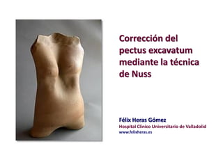 Corrección del
pectus excavatum
mediante la técnica
de Nuss

Félix Heras Gómez
Hospital Clínico Universitario de Valladolid
www.felixheras.es

 