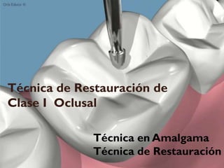 Técnica de Restauración de
Clase I Oclusal
Técnica en Amalgama
Técnica de Restauración
 