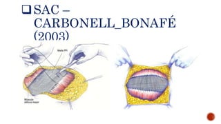 SAC –
CARBONELL_BONAFÉ
(2003)
 