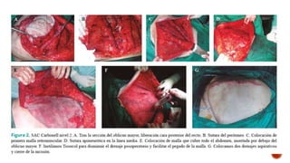 TÉCNICA DE SEPARACIÓN DE COMPONENTES.pptx