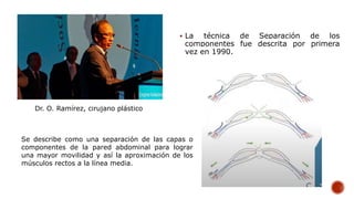  La técnica de Separación de los
componentes fue descrita por primera
vez en 1990.
Dr. O. Ramírez, cirujano plástico
Se describe como una separación de las capas o
componentes de la pared abdominal para lograr
una mayor movilidad y así la aproximación de los
músculos rectos a la línea media.
 