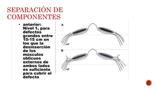 SEPARACIÓN DE
COMPONENTES
 