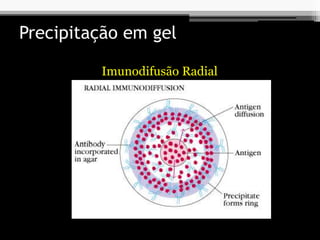 Precipitação em gel
Imunodifusão Radial
 