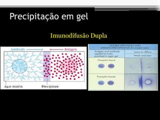 Precipitação em gel
Imunodifusão Dupla
 