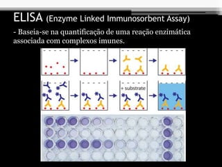 ELISA (Enzyme Linked Immunosorbent Assay)
- Baseia-se na quantificação de uma reação enzimática
associada com complexos imunes.
 