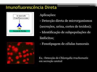 Imunofluorescência Direta
Aplicações:
- Detecção direta de microrganismos
(secreções, urina, cortes de tecidos);
- Identificação de subpopulações de
linfócitos;
- Fenotipagem de células tumorais
Ex.: Detecção de Chlamydia trachomatis
em secreção uretral
 