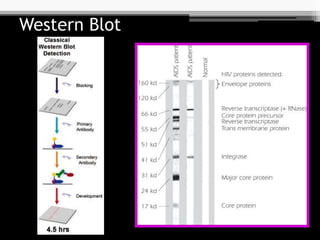 Western Blot
 