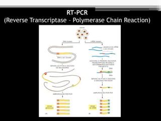 RT-PCR
(Reverse Transcriptase – Polymerase Chain Reaction)
 