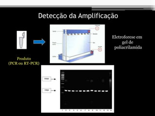 Detecção da Amplificação
Produto
(PCR ou RT-PCR)
Eletroforese em
gel de
poliacrilamida
 