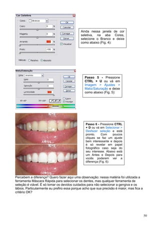 Ainda nessa janela de cor
                                             seletiva, na aba Cores,
                                             selecione o Branco e deixe
                                             como abaixo (Fig. 4):




                                               Passo 5 - Pressione
                                               CTRL + U ou vá em
                                               Imagem > Ajustes >
                                               Matiz/Saturação e deixe
                                               como abaixo (Fig. 5):




                                                Passo 6 - Pressione CTRL
                                                + D ou vá em Selecionar >
                                                Desfazer seleção e está
                                                pronto.     Com     poucos
                                                cliques se faz um ajuste
                                                bem interessante e depois
                                                é só revelar em papel
                                                fotográfico caso seja do
                                                seu interesse. Abaixo está
                                                um Antes e Depois para
                                                vocês poderem ver a
                                                diferença (Fig. 6):




Percebem a diferença? Quero fazer aqui uma observação: nessa matéria foi utilizada a
ferramenta Máscara Rápida para selecionar os dentes, mas qualquer ferramenta de
seleção é viável. É só tomar os devidos cuidados para não selecionar a gengiva e os
lábios. Particularmente eu prefiro essa porque acho que sua precisão é maior, mas fica a
critério OK?




                                                                                           50
 