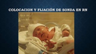 COLOCACION Y FIJACIÓN DE SONDA EN RN
 