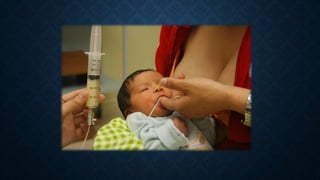 Técnicas de alimentación neonatal