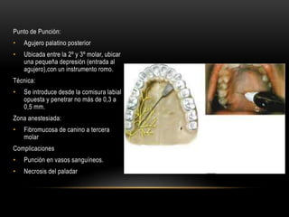 tecnicas-de-anestesia-en-maxilar-superior-ppt