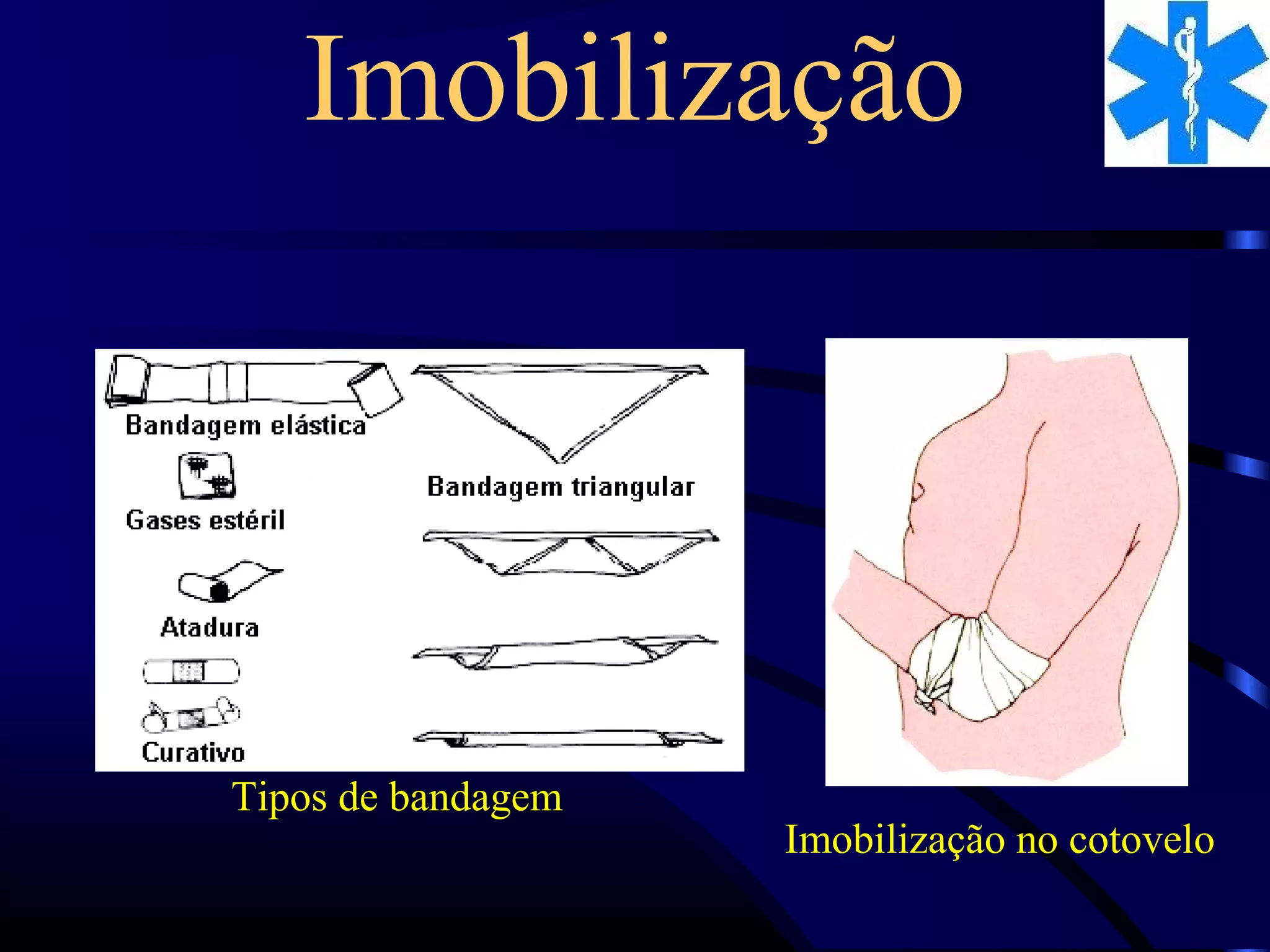 Técnicas de curativos | PPT