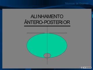 Técnicas de Exames

ALINHAMENTO
ÂNTERO-POSTERIOR

11

 