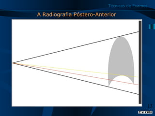 Técnicas de Exames

A Radiografia Póstero-Anterior

13

 