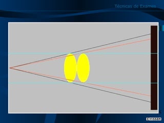 Técnicas de Exames

15

 