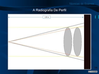 Técnicas de Exames

A Radiografia De Perfil
1,80 m

16

 