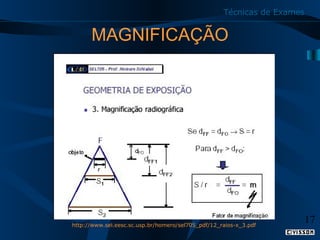 Técnicas de Exames

MAGNIFICAÇÃO

http://www.sel.eesc.sc.usp.br/homero/sel705_pdf/12_raios-x_3.pdf

17

 