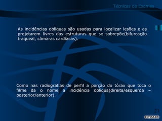 Técnicas de Exames

As incidências oblíquas são usadas para localizar lesões e as
projetarem livres das estruturas que se sobrepõe(bifurcação
traqueal, câmaras cardíacas).

Como nas radiografias de perfil a porção do tórax que toca o
filme da o nome a incidência oblíqua(direita/esquerda –
posterior/anterior).

21

 