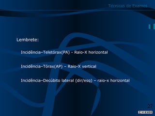 Técnicas de Exames

Lembrete:
Incidência–Teletórax(PA) - Raio-X horizontal
Incidência–Tórax(AP) – Raio-X vertical
Incidência–Decúbito lateral (dir/esq) – raio-x horizontal

27

 