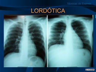 Técnicas de Exames

LORDÓTICA

30

 