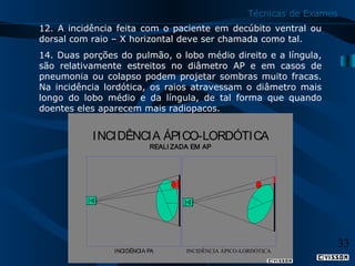 Técnicas de Exames
12. A incidência feita com o paciente em decúbito ventral ou
dorsal com raio – X horizontal deve ser chamada como tal.
14. Duas porções do pulmão, o lobo médio direito e a língula,
são relativamente estreitos no diâmetro AP e em casos de
pneumonia ou colapso podem projetar sombras muito fracas.
Na incidência lordótica, os raios atravessam o diâmetro mais
longo do lobo médio e da língula, de tal forma que quando
doentes eles aparecem mais radiopacos.

I NCIDÊNCIA ÁPICO-LORDÓTICA
REALI ZADA EM AP

INCIDÊNCIA PA

INCIDÊNCIA ÁPICO-LORDÓTICA

33

 