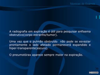 Técnicas de Exames

A radiografia em expiração é útil para pesquisar enfisema
obstrutivo(corpo estranho/tumor).
Uma vez que o pulmão obstruído não pode se esvaziar
prontamente o lado afetado permanecerá expandido e
hiper-transparente(escuro).
O pneumotórax aparece sempre maior na expiração.

36

 
