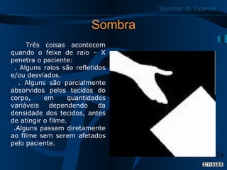 Técnicas de Exames

Sombra
Três coisas acontecem
quando o feixe de raio – X
penetra o paciente:
. Alguns raios são refletidos
e/ou desviados.
. Alguns são parcialmente
absorvidos pelos tecidos do
corpo,
em
quantidades
variáveis
dependendo
da
densidade dos tecidos, antes
de atingir o filme.
.Alguns passam diretamente
ao filme sem serem afetados
pelo paciente.

39

 