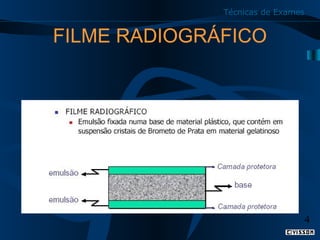 Técnicas de Exames

FILME RADIOGRÁFICO

4

 