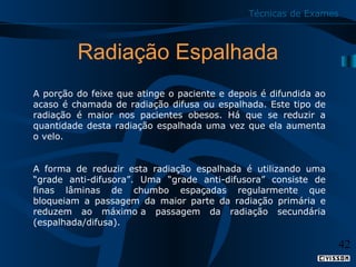Técnicas de Exames

Radiação Espalhada
A porção do feixe que atinge o paciente e depois é difundida ao
acaso é chamada de radiação difusa ou espalhada. Este tipo de
radiação é maior nos pacientes obesos. Há que se reduzir a
quantidade desta radiação espalhada uma vez que ela aumenta
o velo.
A forma de reduzir esta radiação espalhada é utilizando uma
“grade anti-difusora”. Uma “grade anti-difusora” consiste de
finas lâminas de chumbo espaçadas regularmente que
bloqueiam a passagem da maior parte da radiação primária e
reduzem ao máximo a passagem da radiação secundária
(espalhada/difusa).

42

 