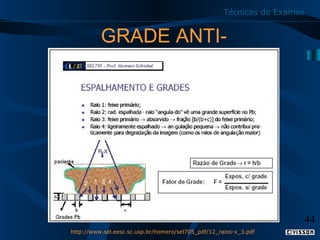 Técnicas de Exames

GRADE ANTIDIFUSORA

44
http://www.sel.eesc.sc.usp.br/homero/sel705_pdf/12_raios-x_3.pdf

 