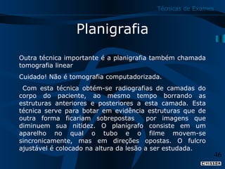 Técnicas de Exames

Planigrafia
Outra técnica importante é a planigrafia também chamada
tomografia linear
Cuidado! Não é tomografia computadorizada.
Com esta técnica obtém-se radiografias de camadas do
corpo do paciente, ao mesmo tempo borrando as
estruturas anteriores e posteriores a esta camada. Esta
técnica serve para botar em evidência estruturas que de
outra forma ficariam sobrepostas
por imagens que
diminuem sua nitidez. O planígrafo consiste em um
aparelho no qual o tubo e o filme movem-se
sincronicamente, mas em direções opostas. O fulcro
ajustável é colocado na altura da lesão a ser estudada.

46

 