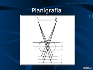 Técnicas de Exames

Planigrafia

47

 