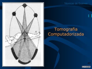 Técnicas de Exames

Tomografia
Computadorizada

49

 