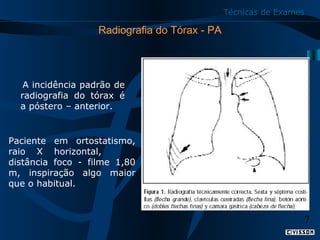 Técnicas de Exames

Radiografia do Tórax - PA

    A incidência padrão de 
radiografia  do  tórax  é 
a póstero – anterior.

Paciente  em  ortostatismo, 
raio  X  horizontal,       
distância  foco  -  filme  1,80 
m,  inspiração  algo  maior 
que o habitual.

7

 