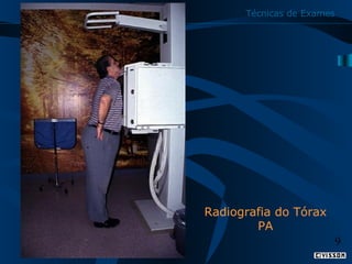 Técnicas de Exames

Radiografia do Tórax
PA
9

 