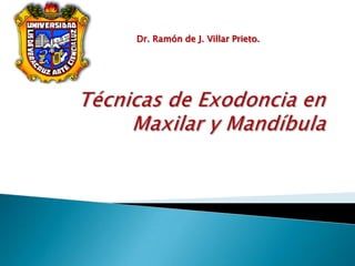Técnicas de Exodoncia en Maxilar y Mandíbula         Dr. Ramón de J. Villar Prieto.  