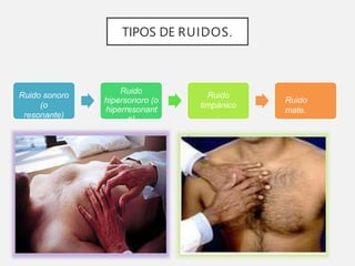 TIPOS DE RUIDOS.
Ruido sonoro
(o
resonante)
Ruido
hipersonoro (o
hiperresonant
e)
Ruido
timpánico
.
Ruido
mate.
 