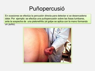 Puñopercusió
n.
En ocasiones se efectúa la percusión directa para detectar si se desencadena
dolor. Por ejemplo: se efectúa una puñopercusión sobre las fosas lumbares,
ante la sospecha de una pielonefritis (el golpe se aplica con la mano formando
un puño).
 