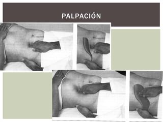 PALPACIÓN
 