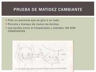  Pida un paciente que se gire a un lado.
 Percuta y marque de nuevo los bordes.
 Los bordes entre el timpanismo y matidez: NO SON
CONSTANTES.
PRUEBA DE MATIDEZ CAMBIANTE
 