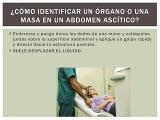  Enderezca y ponga duros los dedos de una mano y colóquelos
juntos sobre la superficie abdominal y aplique un golpe rápido
y directo hacia la estructura prevista.
 SUELE DESPLAZAR EL LÍQUIDO.
¿CÓMO IDENTIFICAR UN ÓRGANO O UNA
MASA EN UN ABDOMEN ASCÍTICO?
 